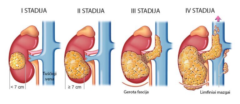 inkst-ir-s-klid-i-v-ys-urologas-kaune